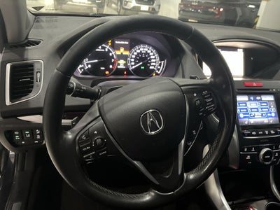 2015 Acura TLX 3.5 ADVANCE AT
